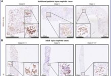 Διεθνής έρευνα με ελληνική συμμετοχή προτείνει καινοτόμα θεραπεία των αιματολογικών καρκίνων